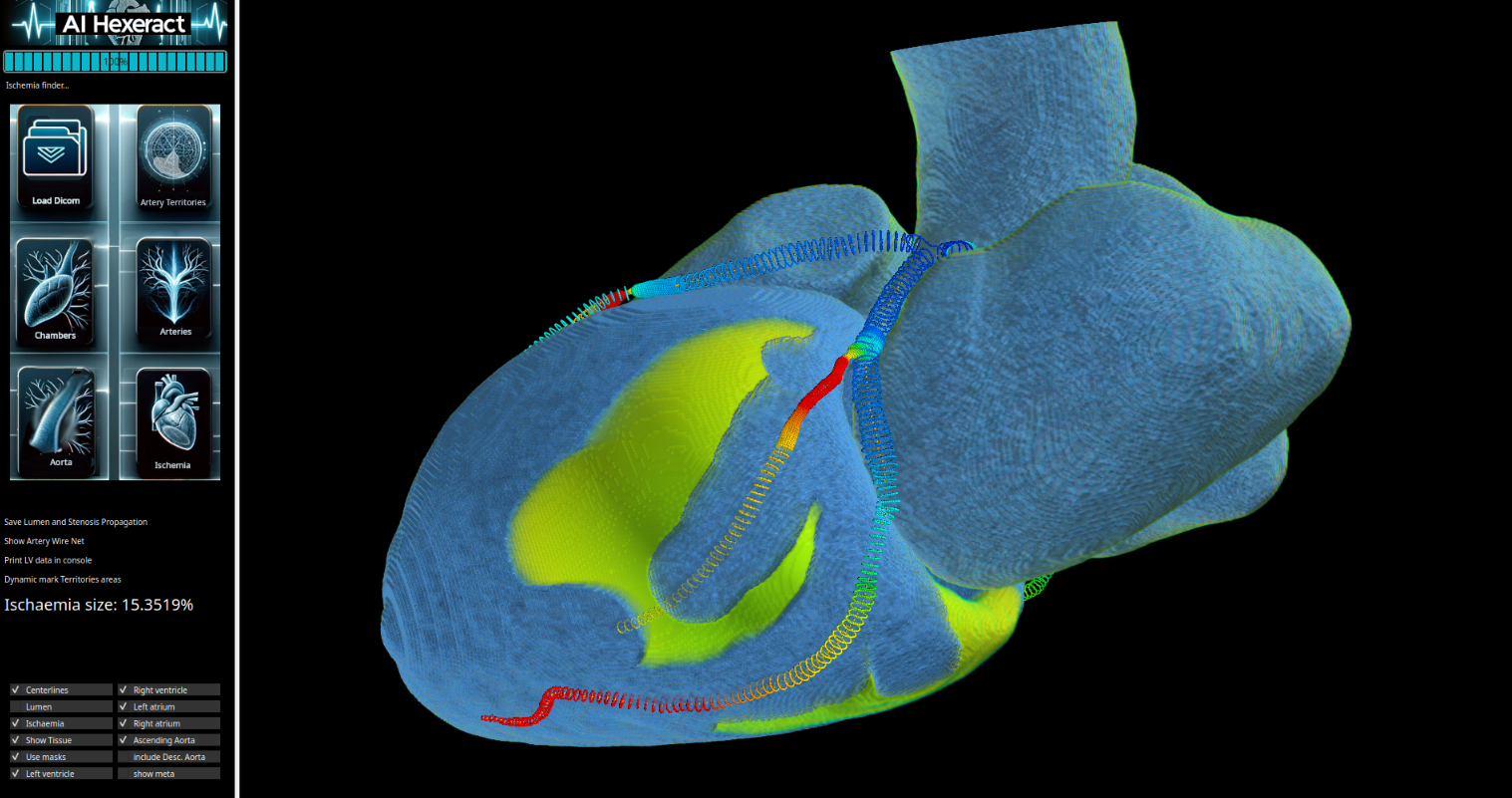 Desktop version – Ischaemia
